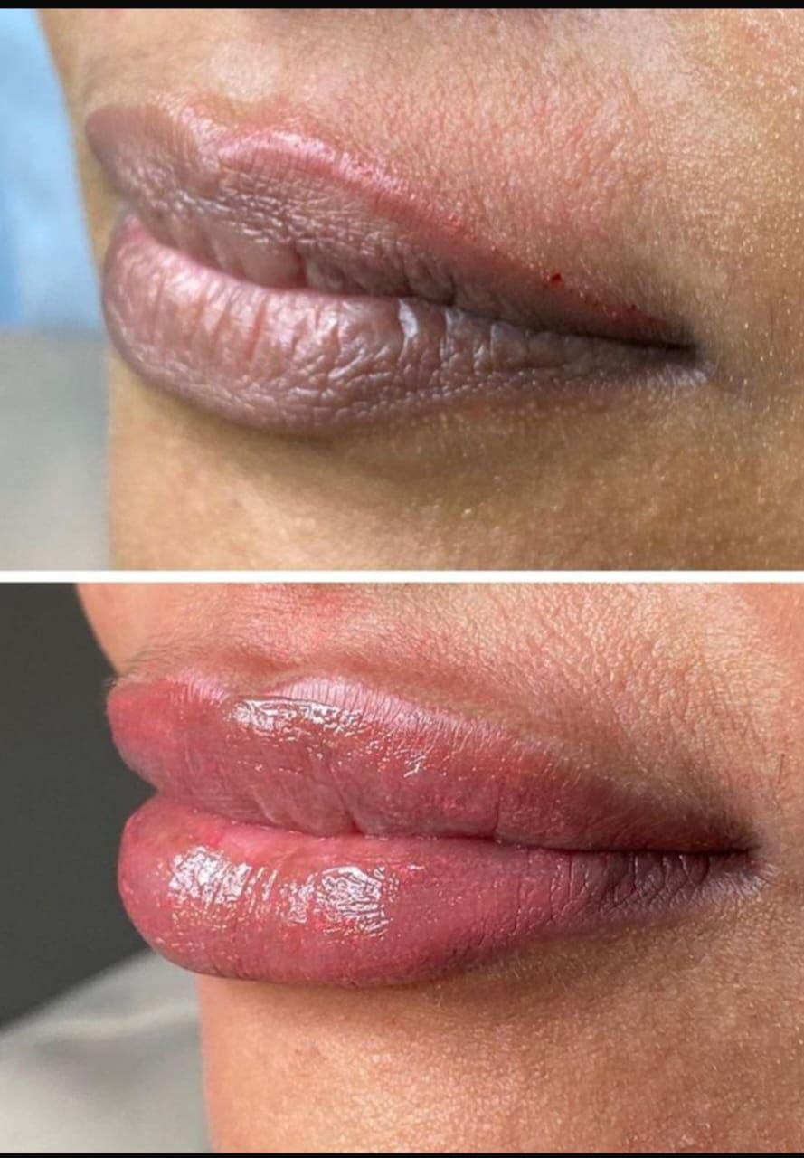 Lip Neutralization Result